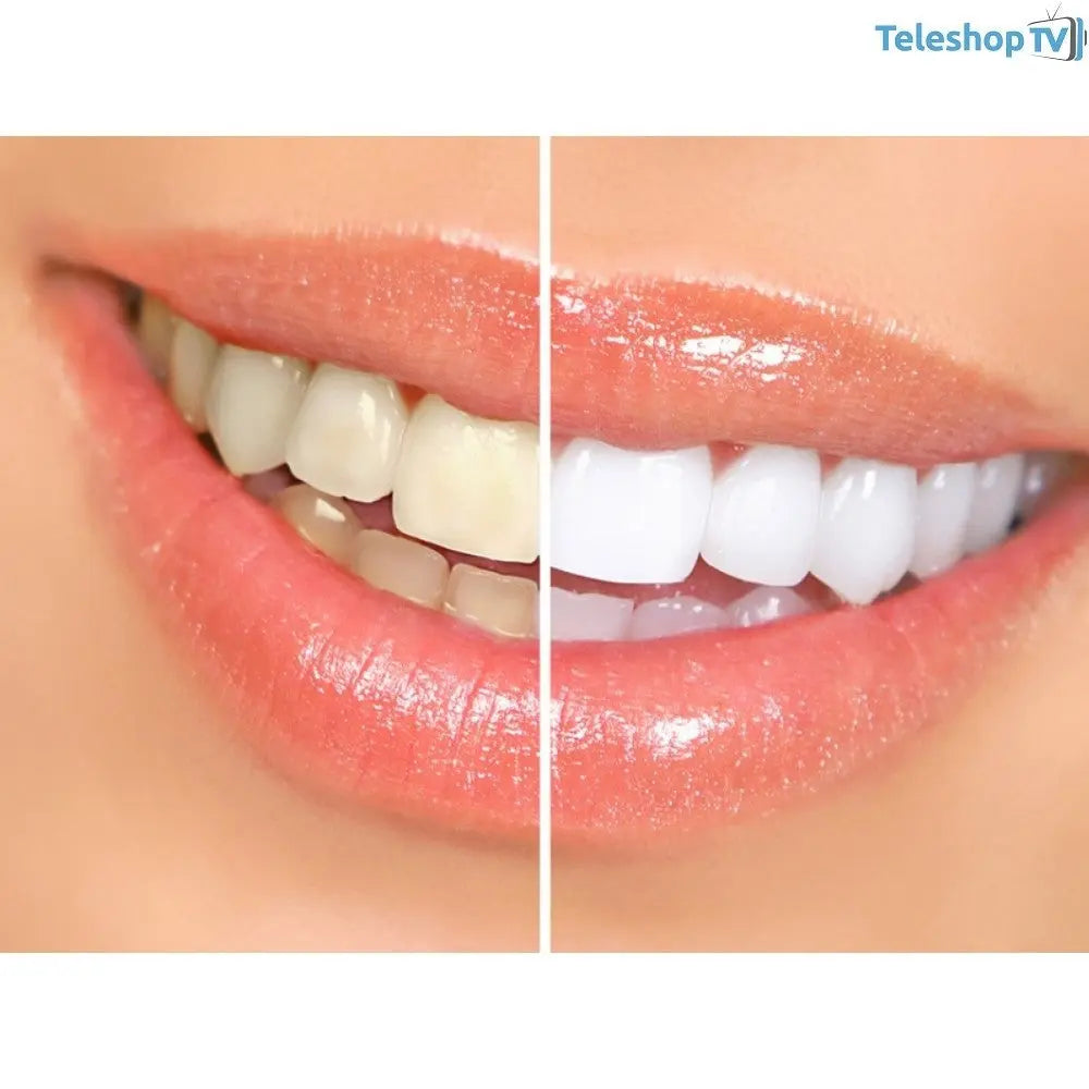 Aparat albire dinti Dental White Original SuperUtil.ro