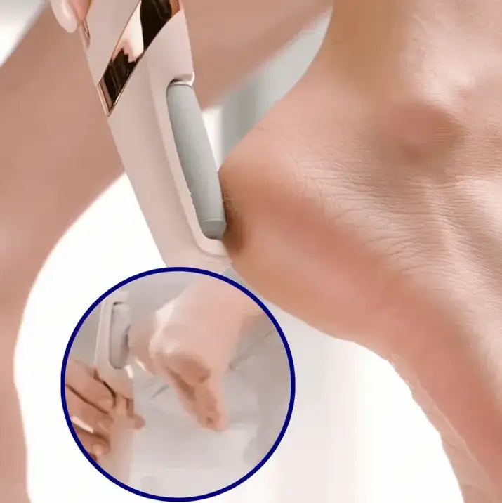 Aparat pentru ingrijire si curatare calcaie BeautyFeet SuperUtil.ro